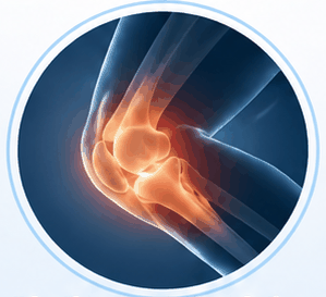 Chaleur articulaire 1
